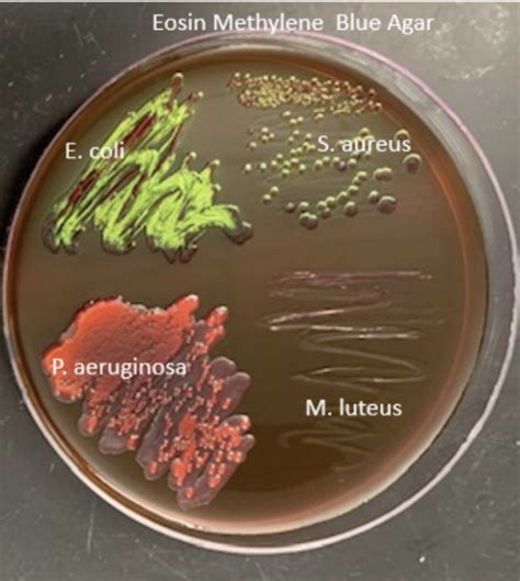 pseudomonas aeruginosa emb|EMB Agar: Composition, Principle, and Colony Morphology.